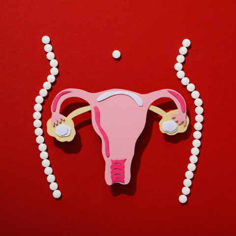 polikistik-over-tedavii